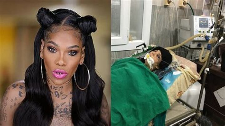 Apple Watts Hospitalized with 'Major Injuries' After Car Accident