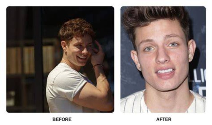 Are Matt Rife's Teeth Real? The Comedian's Choppers Are Just Too Perfect